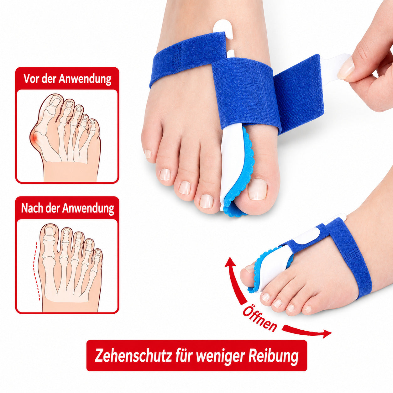 2x Zehenspreizer Zehen-Korrektur Ballenschutz Schiene Hallux Valgus Fuß Bandage