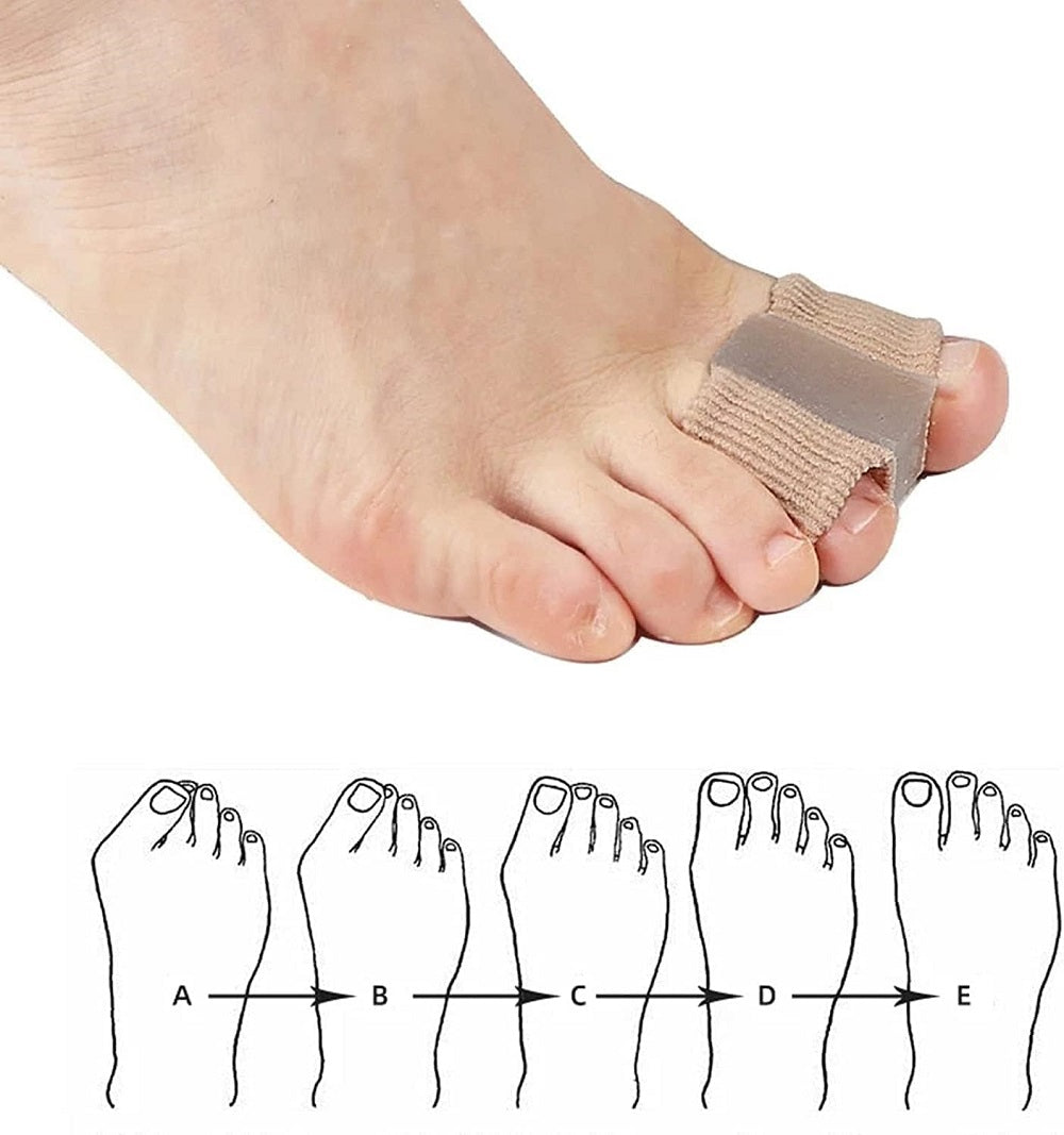 COOL-i Silikon Zehenspreizer, weich & unauffällig, für Tag & Nacht, unisex tragbar,2 Stk.