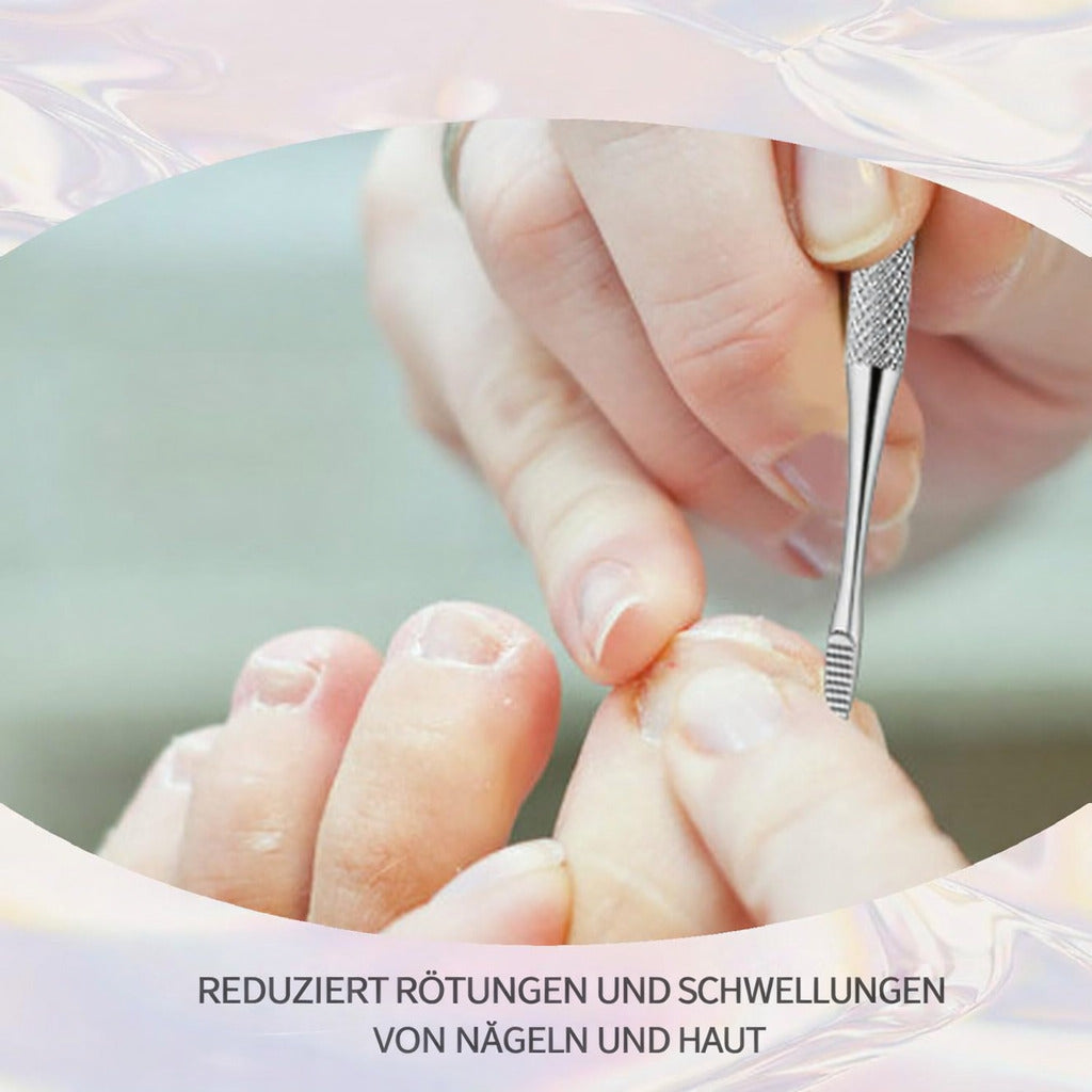 Cool-i® Eingewachsene Zehennägel Pflege Set – Eckenheber & Feile aus Edelstahl – Fußpflege Werkzeug für Pediküre & Maniküre