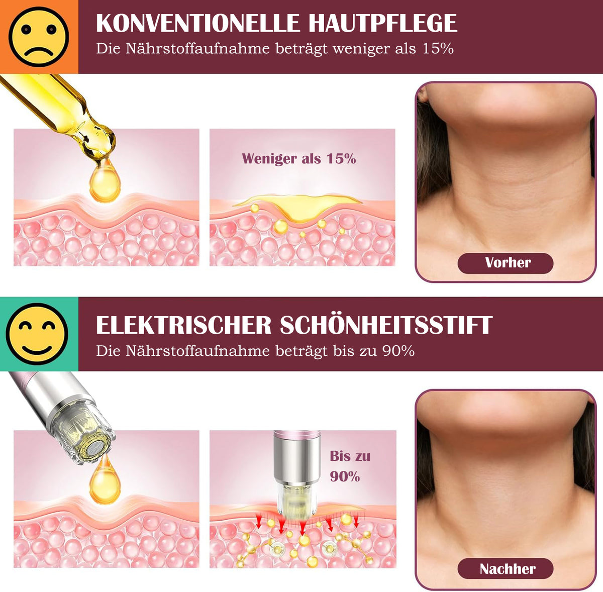 Cool-i ® Microneedling Pen mit Serum-Auftrag – Kabelloser, 5 Stufen Serum gleichmäßig auf Gesicht und Körper auftragen.A3