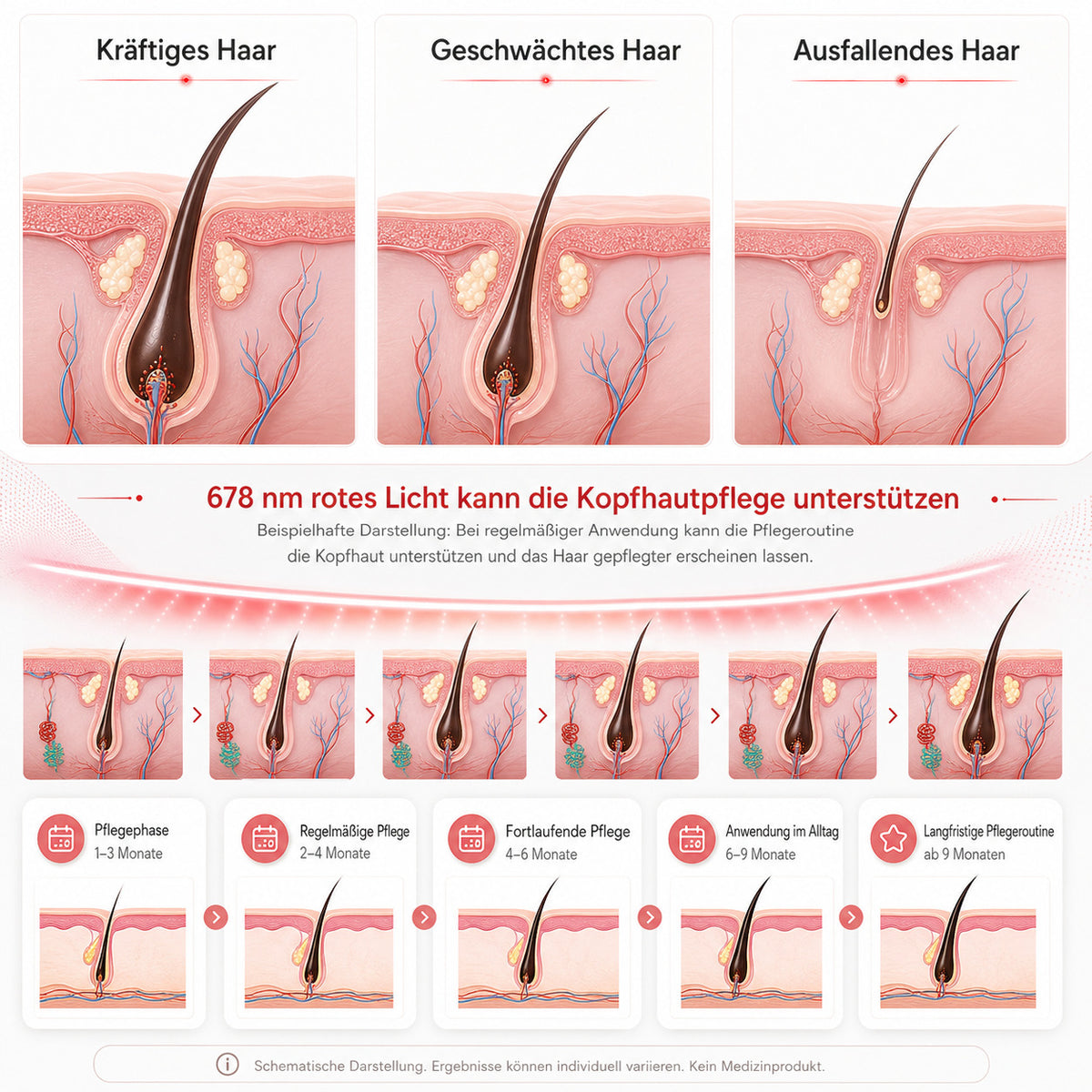 Cool-i ® Infrarotlampe Rotlicht-Haarwuchshaube–Infrarot- & Blaulichttherapie für die Kopfhaut Kabellose,158 LEDs, wiederaufladbar, Timer, für Männer & Frauen
