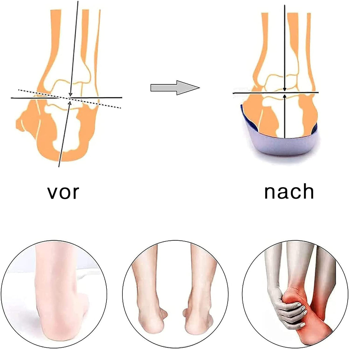 Einlegesohlen 1 Paar TPR Dämpfungseinlagen, Komfort bei Plattfuß & Überpronation