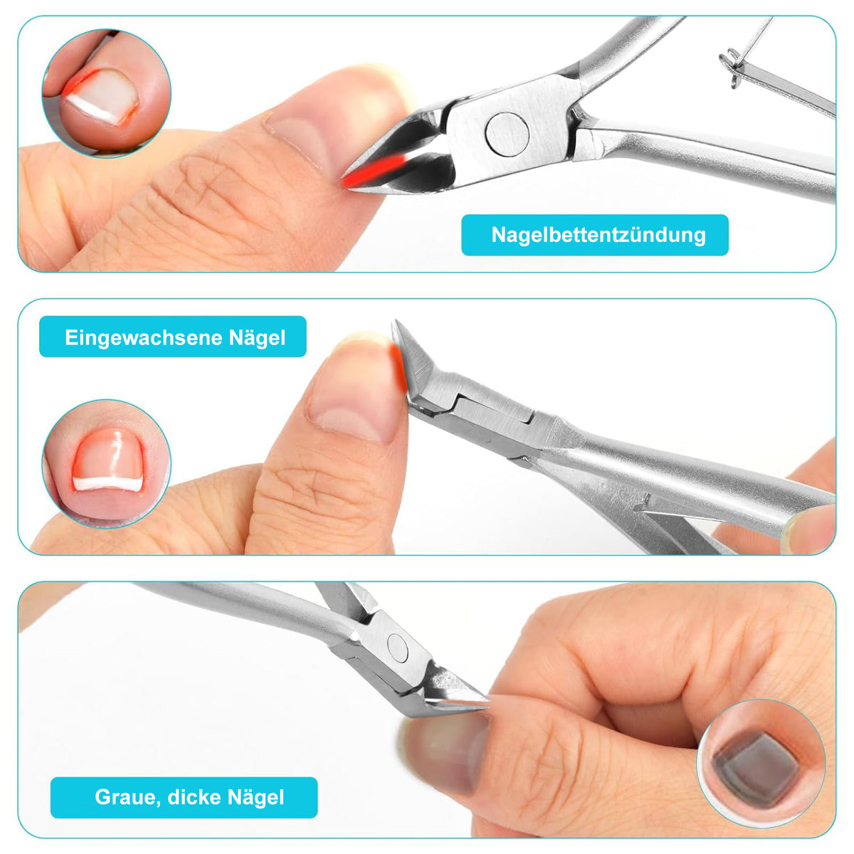 Profi Nagelzange aus Edelstahl – Präzisions-Fußnagelschere für eingewachsene Zehennägel mit rutschfestem Griff