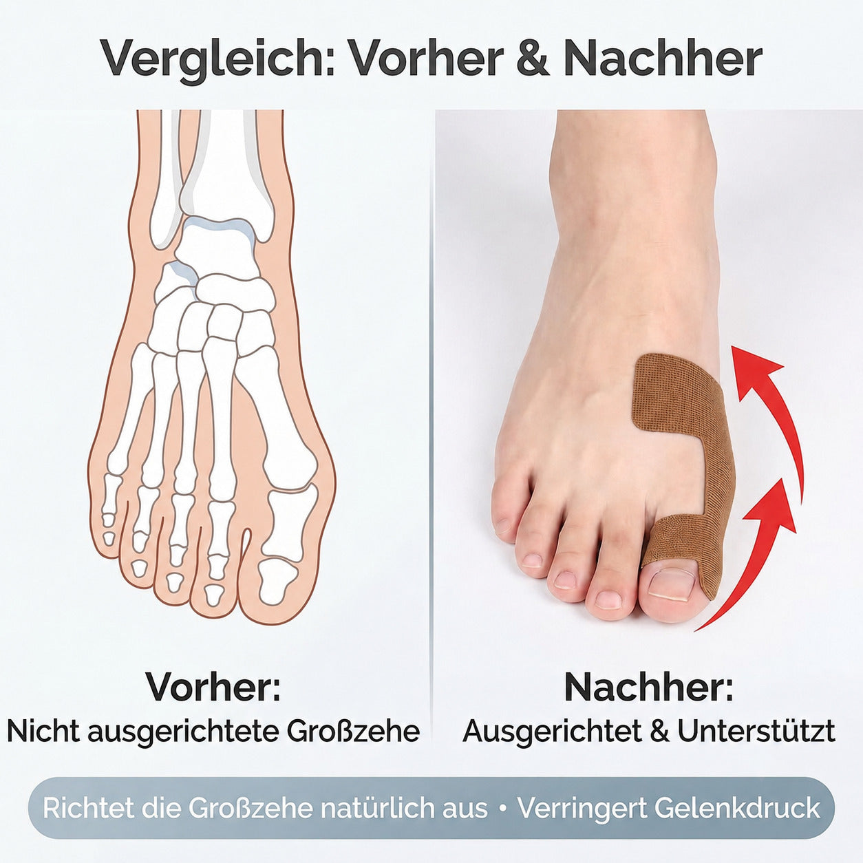 COOL-i 12er Hallux Tape, T-Tape für Großzehe, elastisch, atmungsaktiv & latexfrei