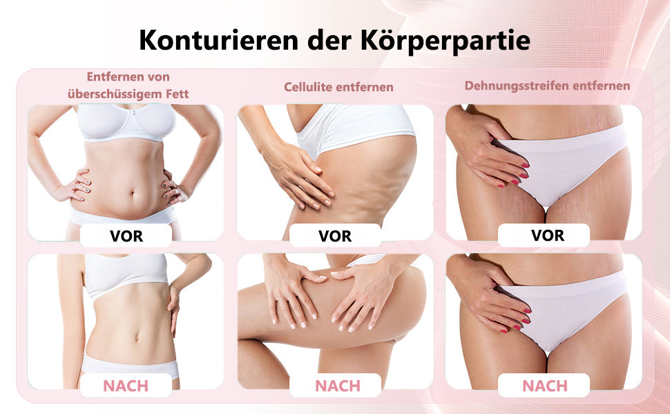 Vorher-Nachher Effekt – Hautstraffung und Fettabbau sichtbar