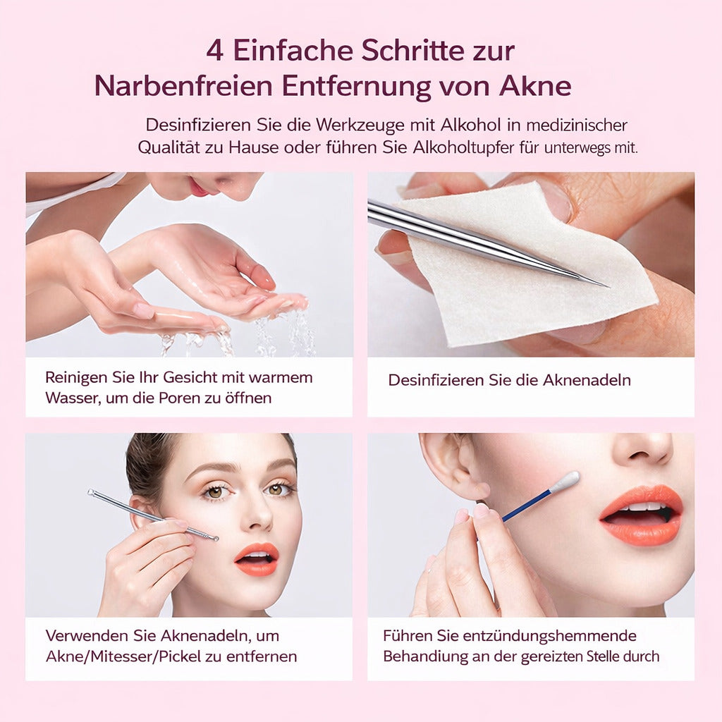 Mitesserentferner,4er Mitesserentferner Komedonenquetscher Set